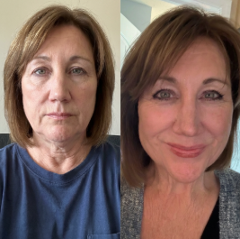 Contour Veil™ – Rytuał konturu twarzy