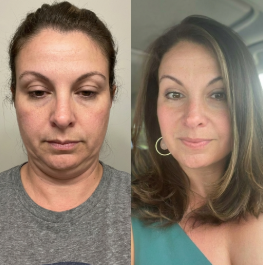 Contour Veil™ – Rytuał konturu twarzy